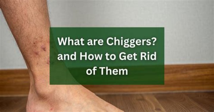 Are chiggers seasonal