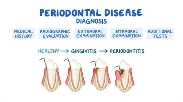 Can dental hygienists diagnose periodontal disease