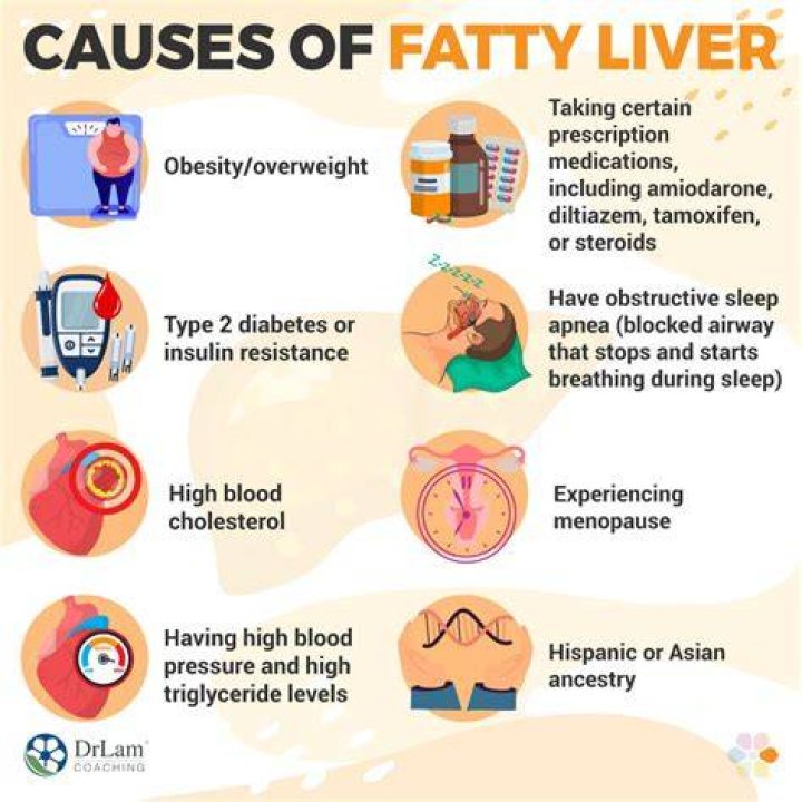 Can fatty liver cause high direct bilirubin?