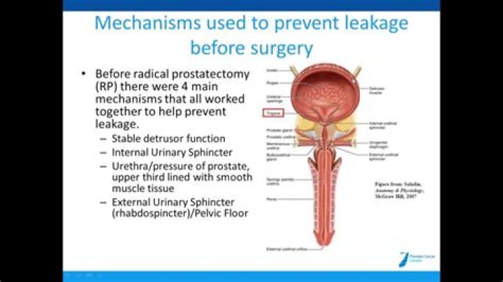 Can part of the prostate be removed