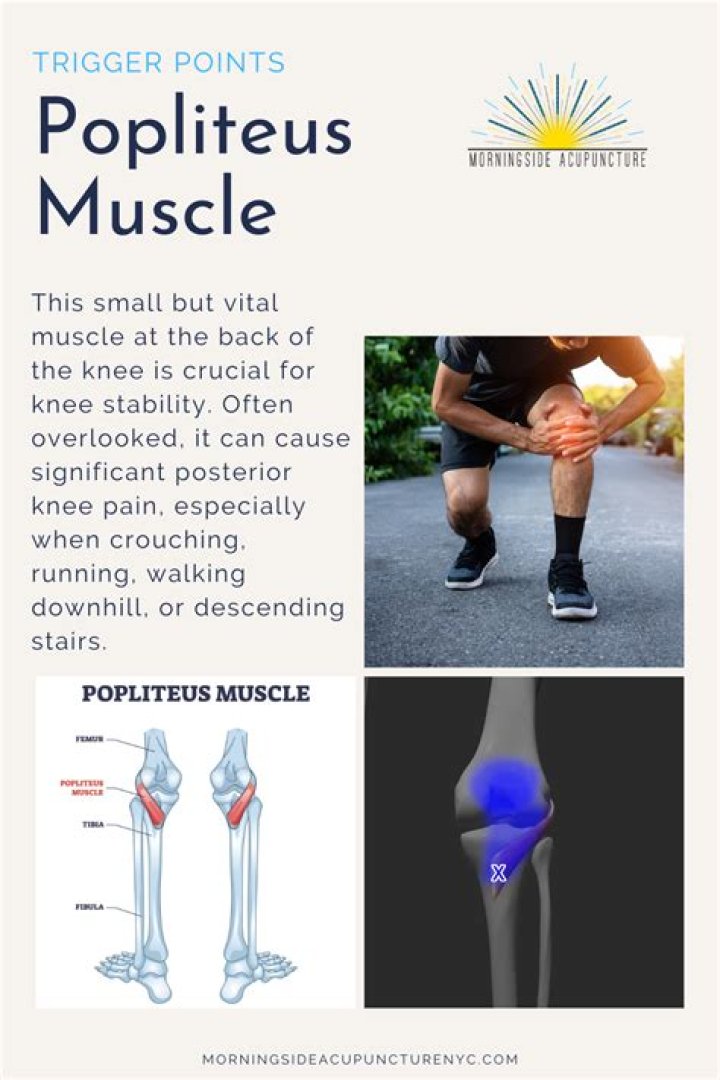 Can you tear your Popliteus muscle