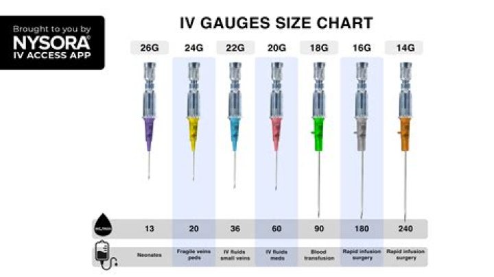 Can you use 15 gauge nails in a 16 gauge nailer