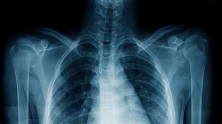 Do organs show up on X-rays?