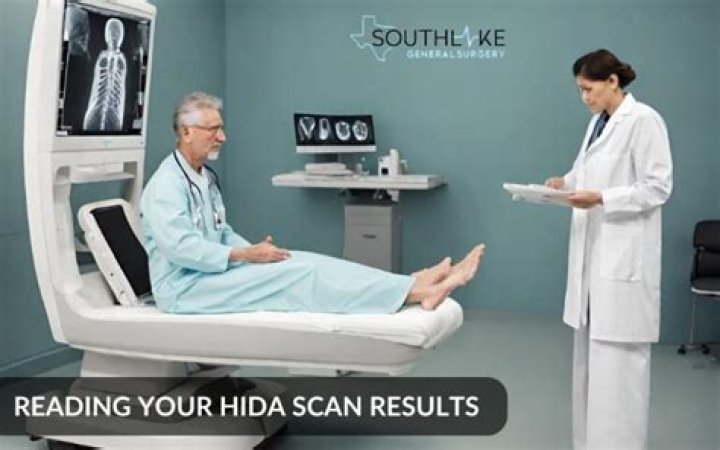 Do you have to drink something for a HIDA scan