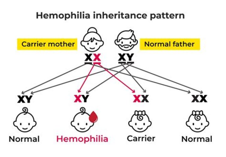 How are hairy ears inherited
