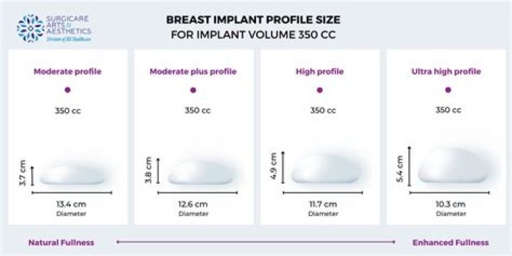 How big is 200cc implants?