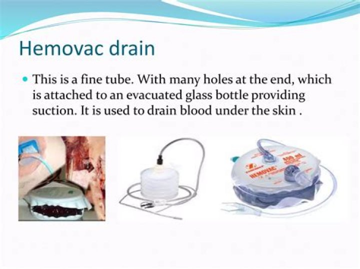 How do morticians drain blood