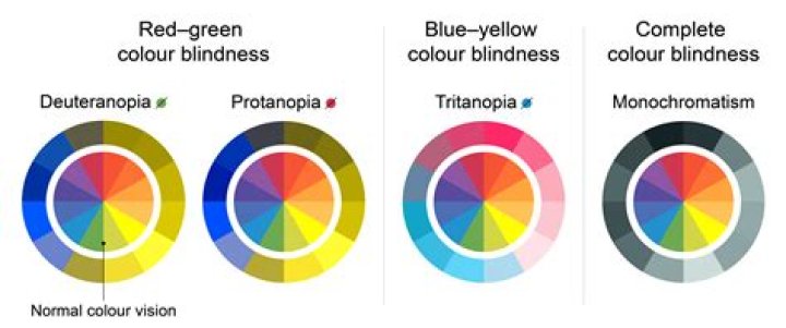 How does blindness vision function as a symbol in Oedipus the King