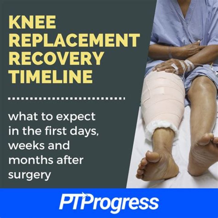 How long does it take to recover from a knee replacement revision?