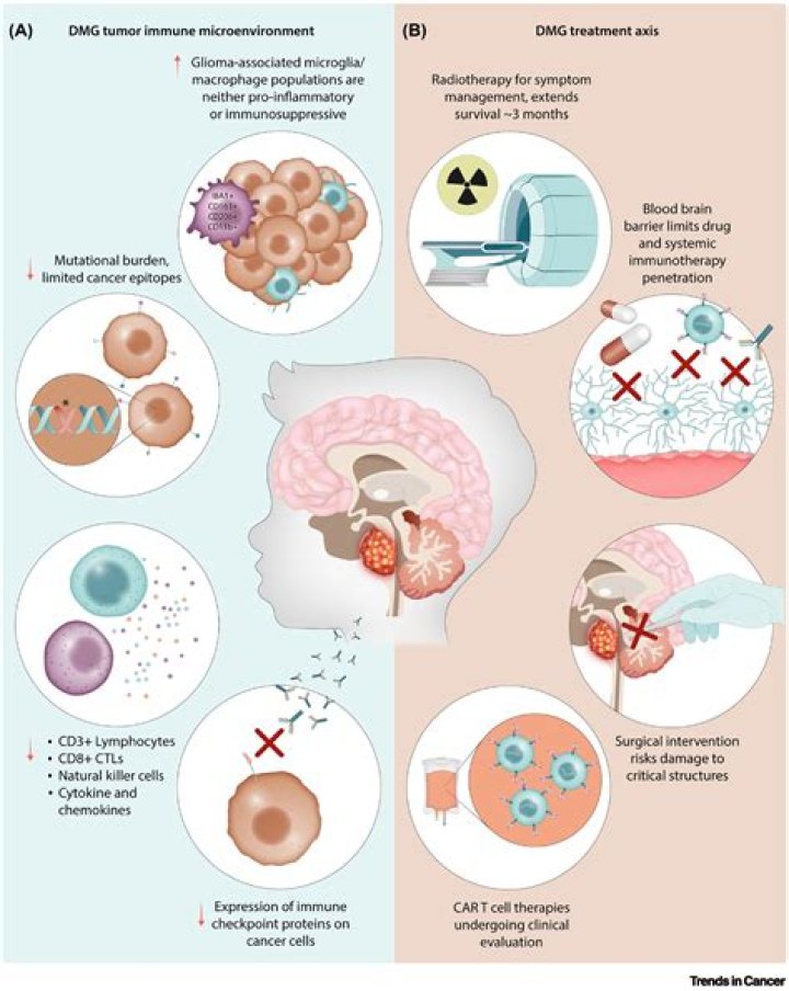 Is a glioma tumor cancer