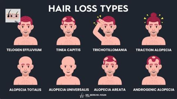 What are the diseases of hair