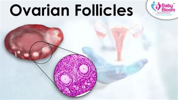 What causes atretic ovarian follicle?