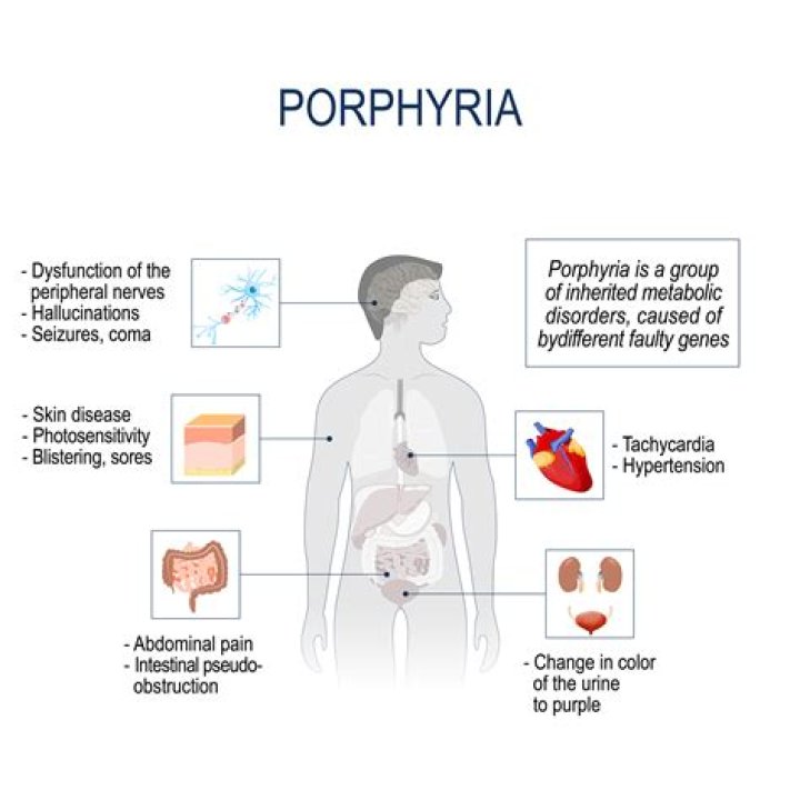 What does a porphyria attack feel like
