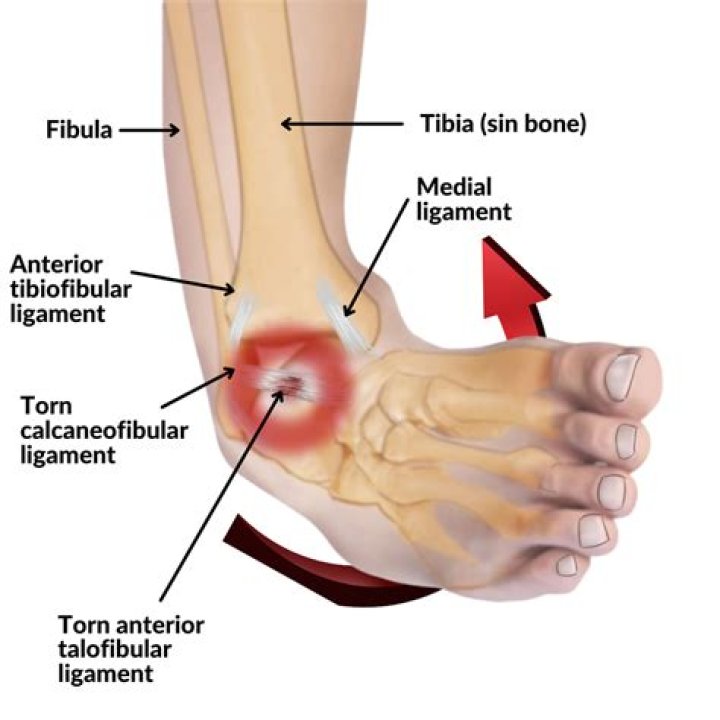 What does the Talofibular ligament do