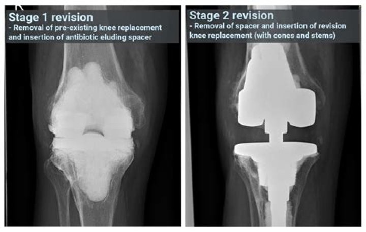 What features help Stabilise the knee joint