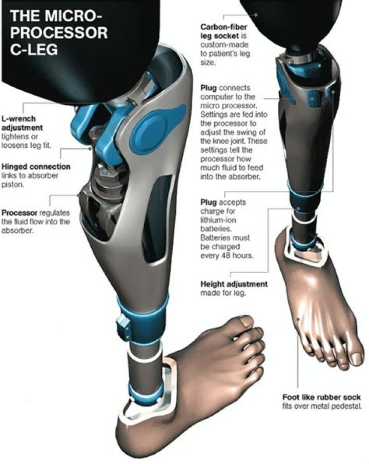 What is a C leg?