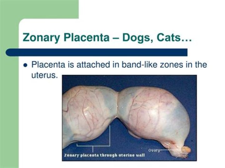What is a Zonary placenta