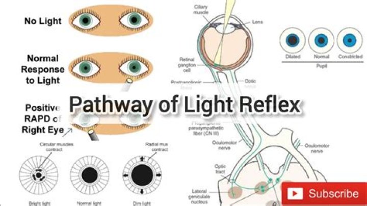 What is arteriolar light reflex