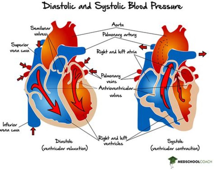 What is bad systolic or diastolic
