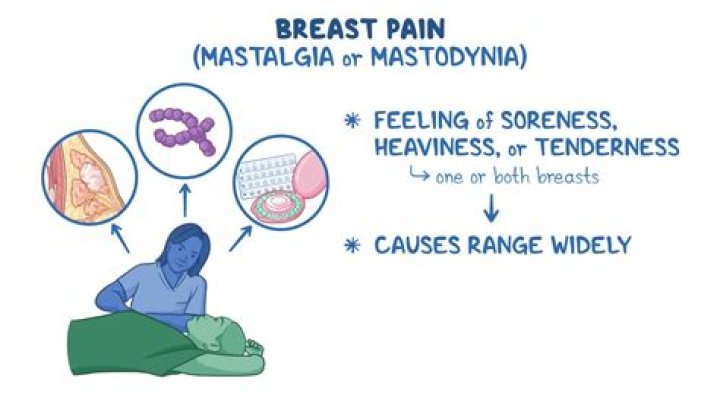 What is breast Mastalgia