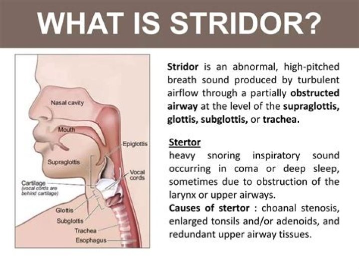 What is inspiratory stridor
