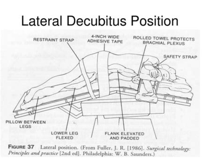 What is lateral decubitus position