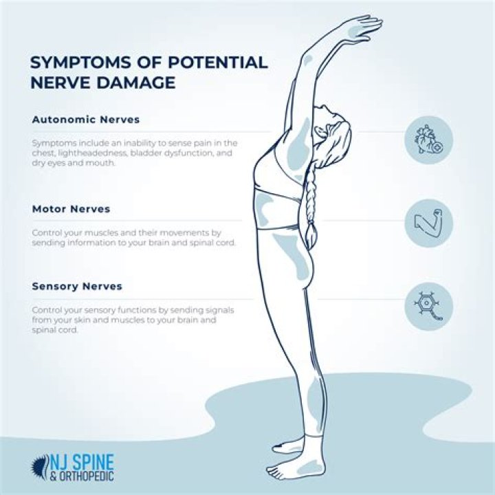 What is nerve problem