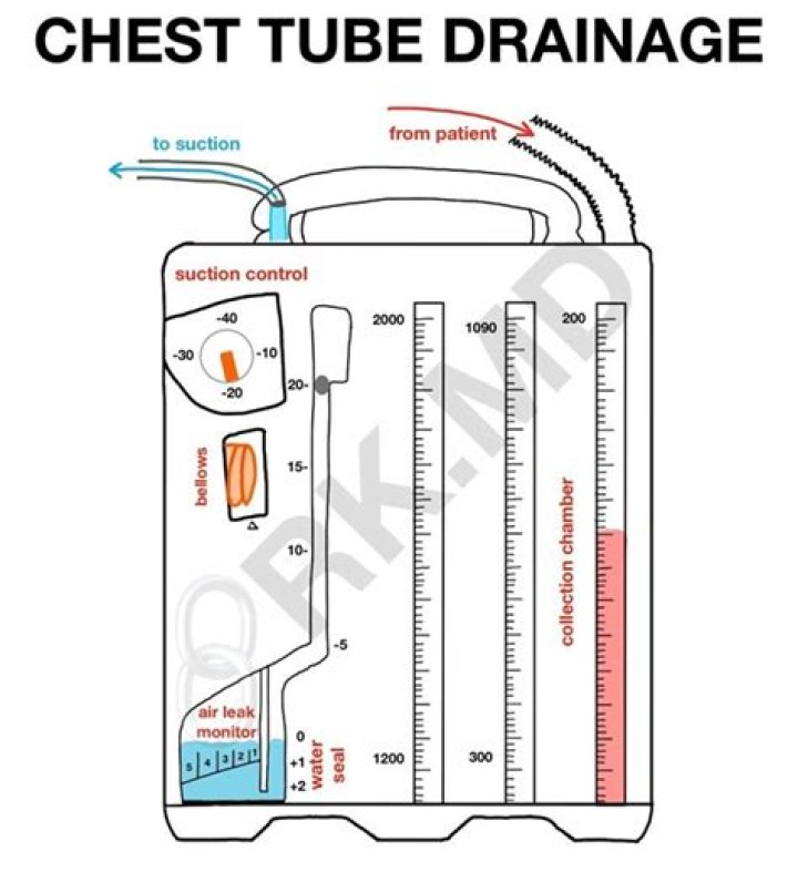 What is normal chest tube drainage amount