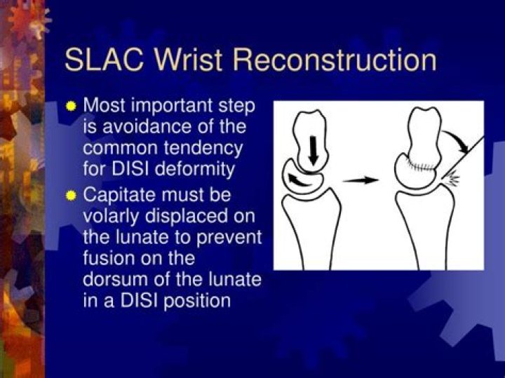 What is SLAC wrist