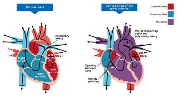 What is TGA eBS?