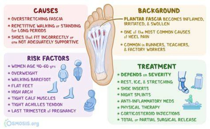 What is the cause of plantar fasciitis