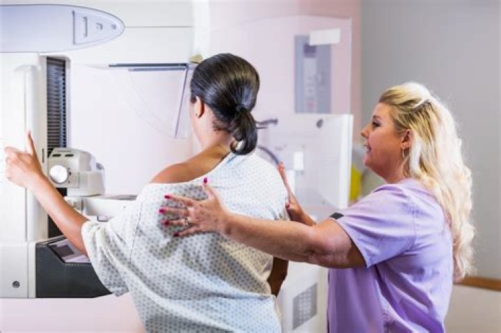 What is the CC view on a mammogram