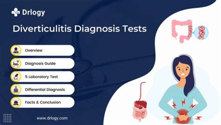 What is the diagnosis code for diverticulitis