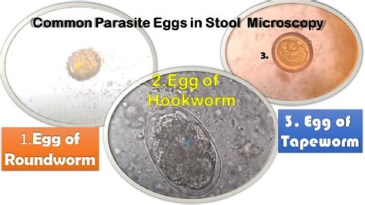 What magnification do you need to see worm eggs