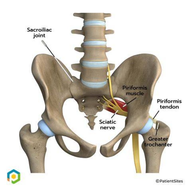 Where is the sciatic notch located on the body?