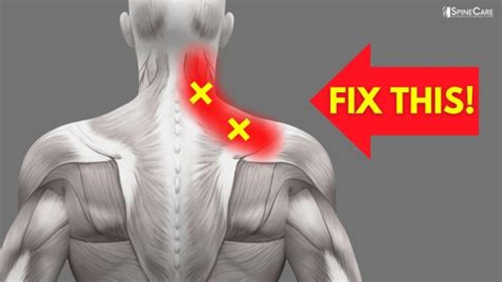 Why am I breaking out on my neck and shoulders?